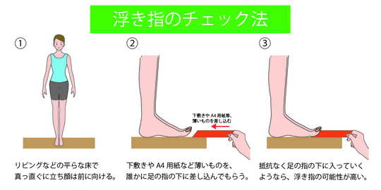 隠れている足の異常 浮き指 指上げ歩行 江戸川区瑞江駅から徒歩5分の整体あすなろ鍼灸整骨院