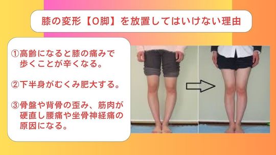 膝の変形・痛み治療【O脚矯正】 - 江戸川区瑞江駅から徒歩5分の